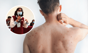 Tulancingo refuerza cerco sanitario ante riesgo de sarampión